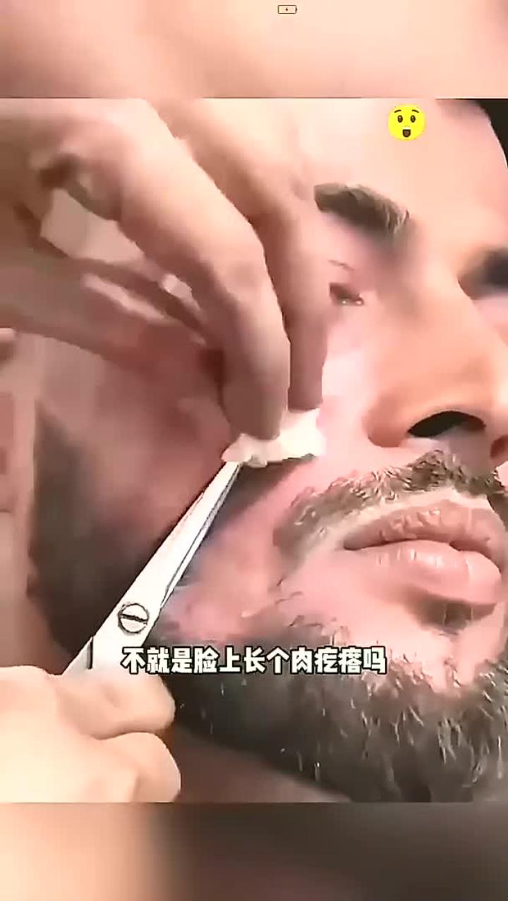 用剪刀剪肉疙瘩,看着都疼