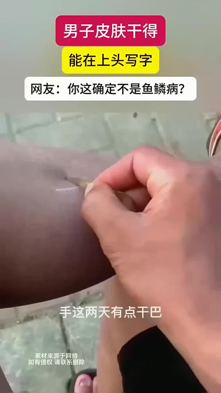 「皮肤干到能写字?」可能是身体在求救!