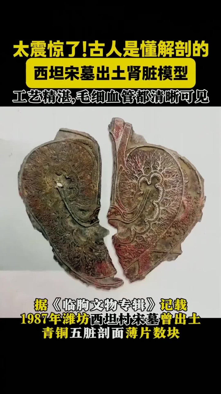 800年前的青铜肾脏,毛细血管清晰可见!太震惊了!古人是懂