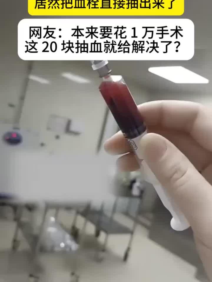 护士抽血意外带出血栓,网友戏称:20元解决万元手术