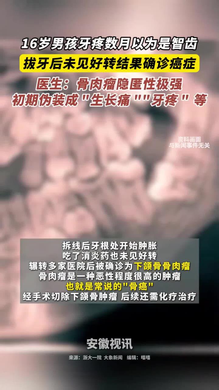 16岁男孩牙疼数月以为是智齿 拔牙后未见好转结果确诊癌症 医生：骨肉瘤隐匿性极强 初