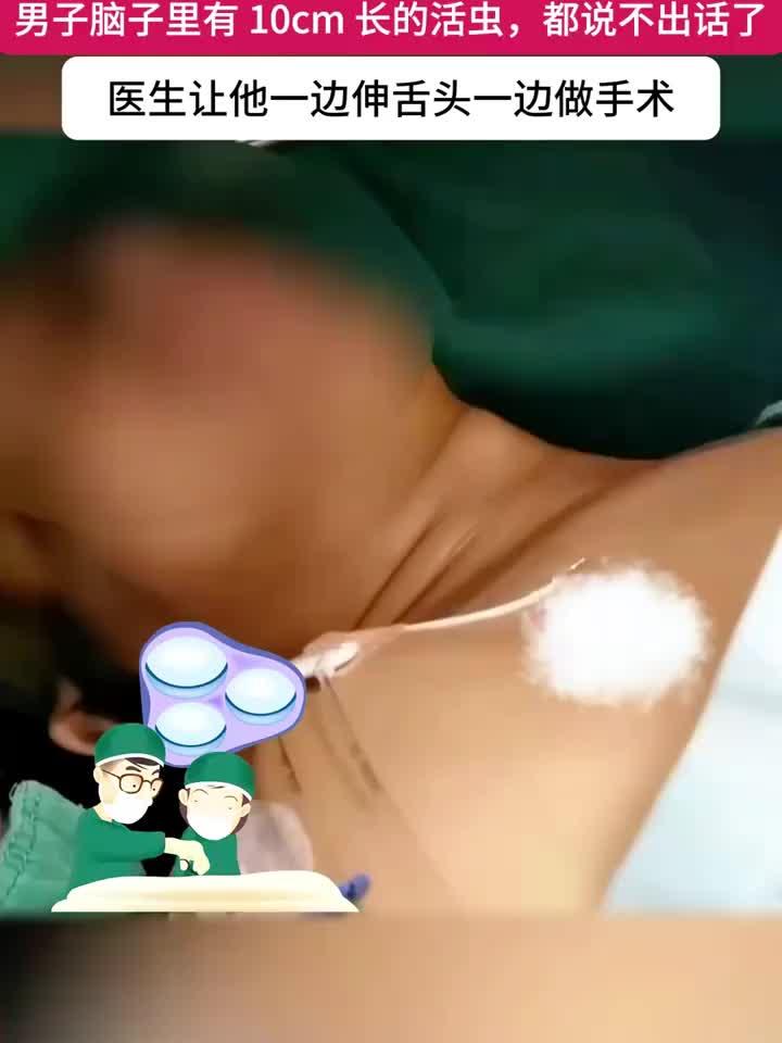 男子脑内活虫长达10厘米,医生竟让他伸舌头配合手术!
