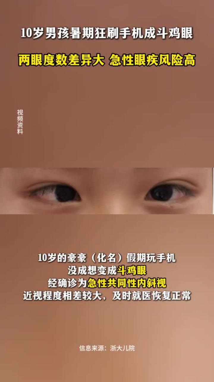 10岁男孩暑期狂刷手机成斗鸡眼