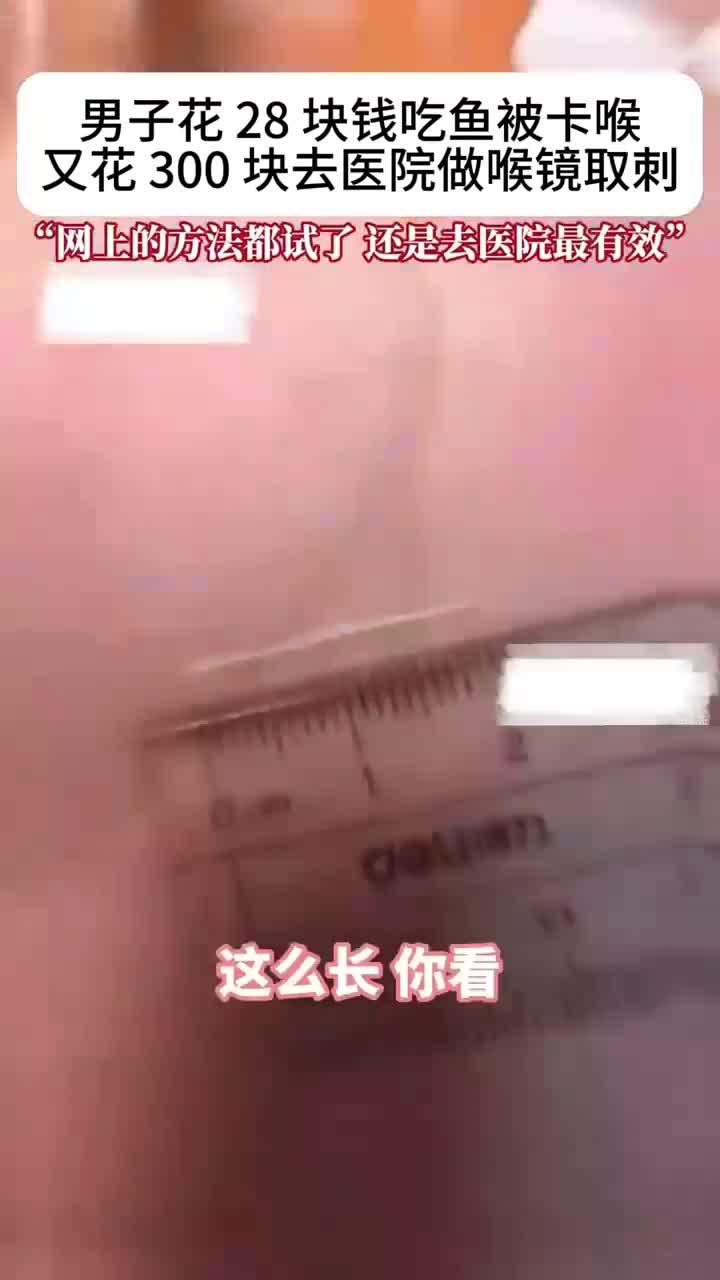 男子花28块吃鱼被卡喉，随后又到医院花300块做喉镜取刺