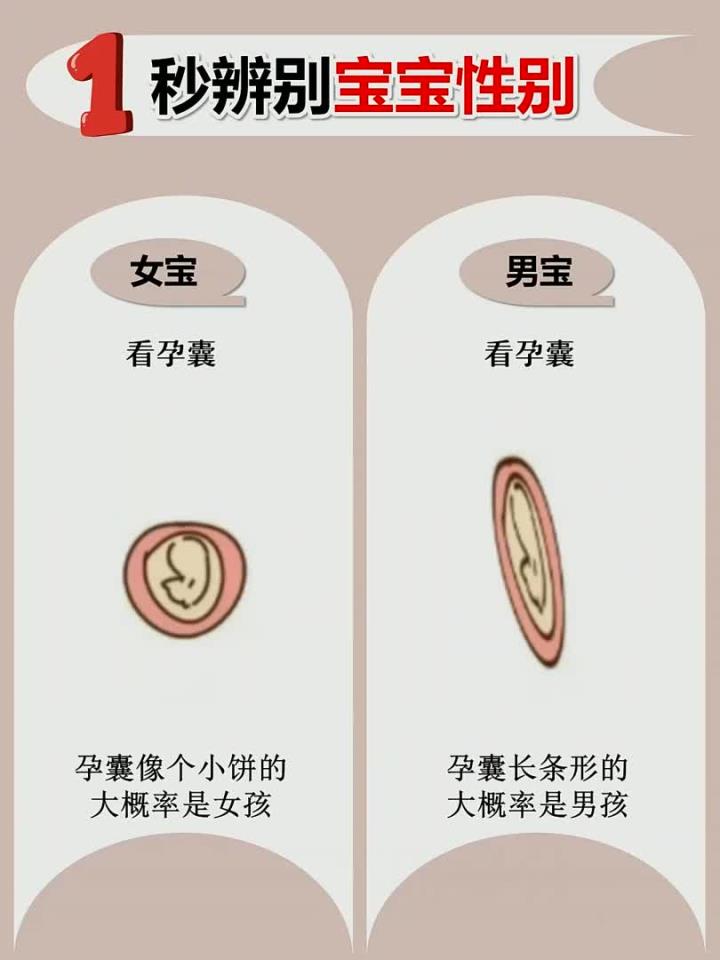 肚子偏上怀大概率是女孩