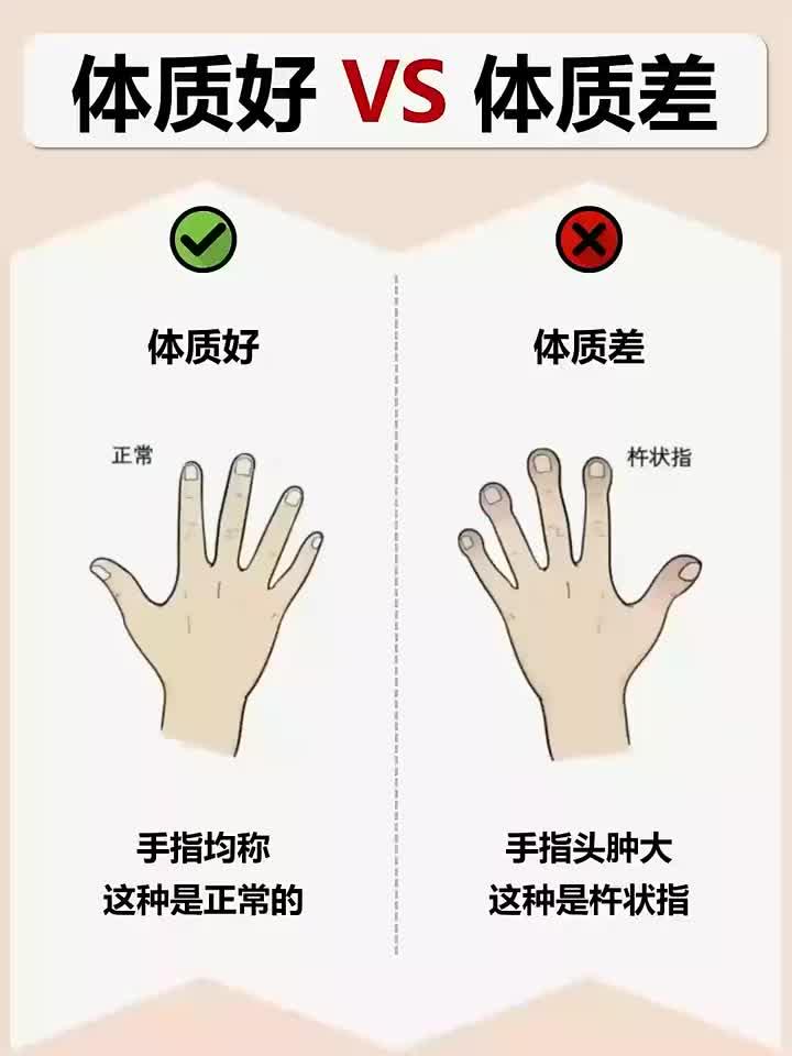 手指健康自测:正常与杵状指对比