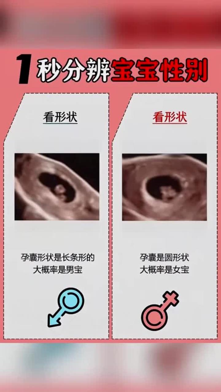 1秒分辨宝宝性别!