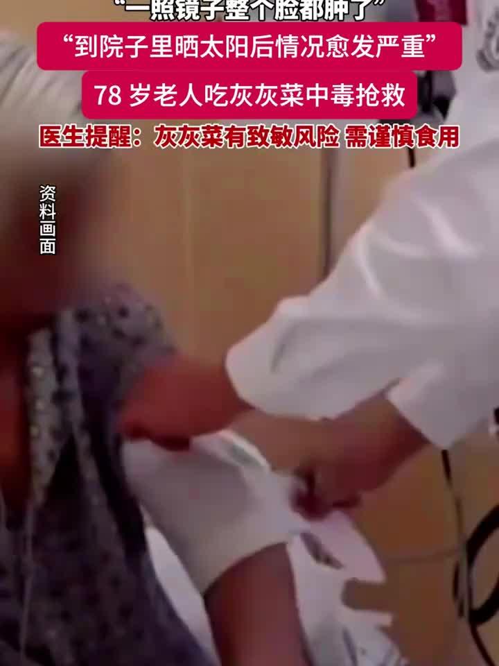 78岁老人食用灰灰菜中毒送医，医生提醒：此类野菜需谨慎处理