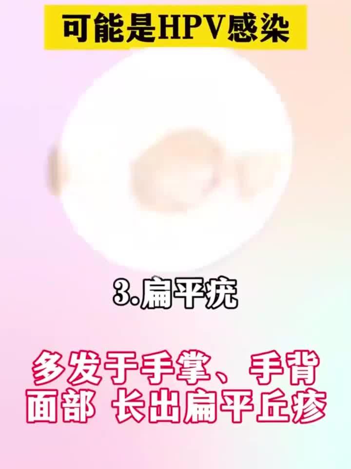 当身体出现这些迹象，警惕HPV悄悄来袭
