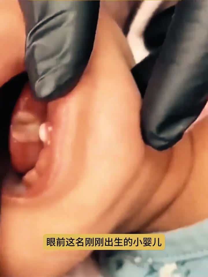 刚出生的小婴儿,嘴里居然长了一颗牙齿