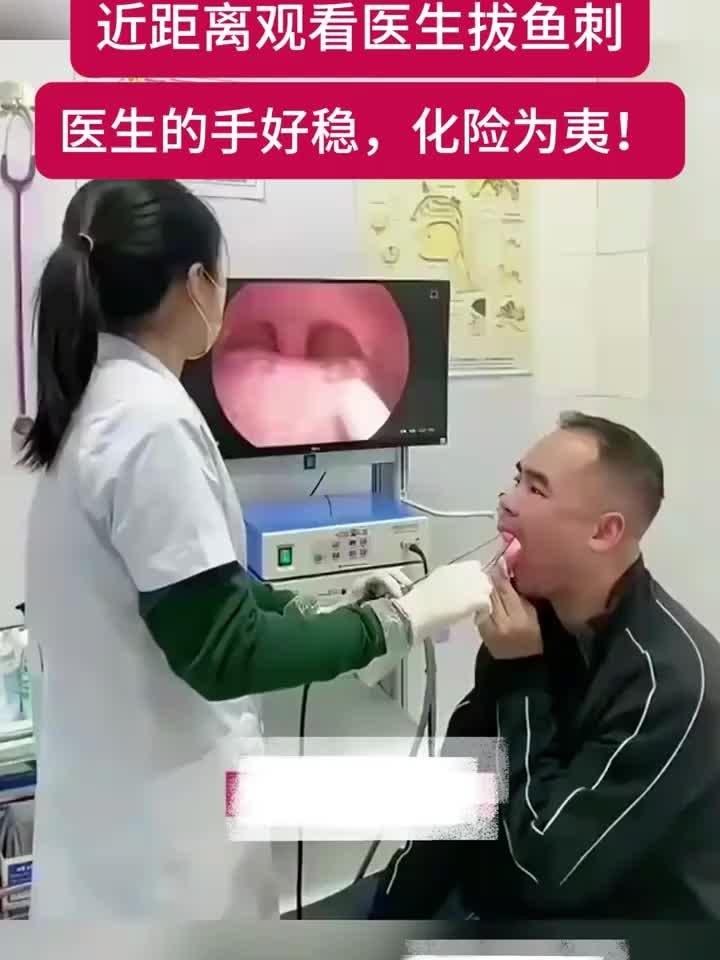 医生巧手取出鱼刺,动作干净利落,患者瞬间轻松!