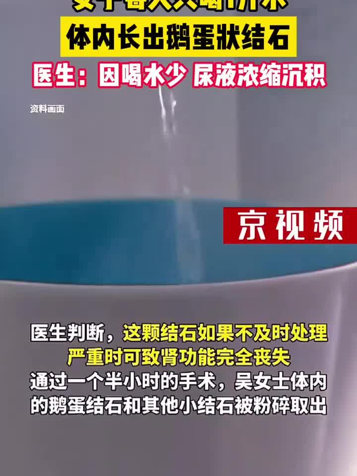 女子每天只喝1升水,体内长出鹅蛋状结石
