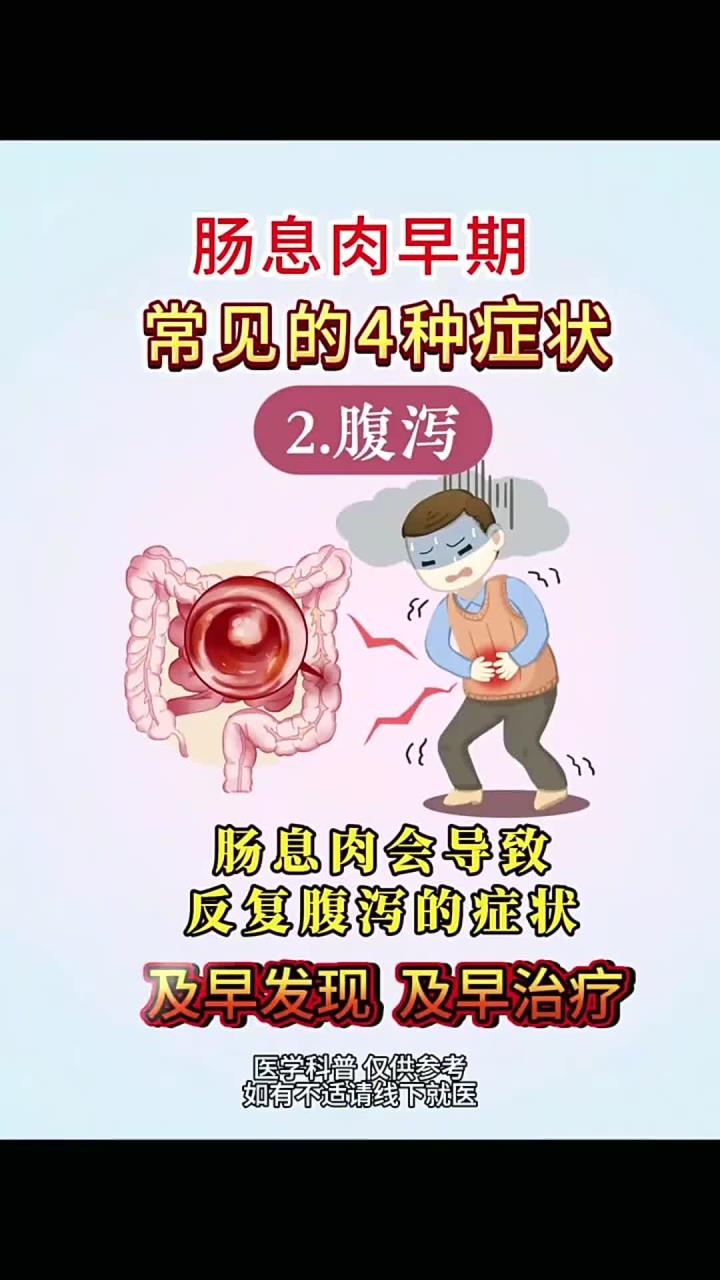 肠息肉早期常见的4种症状