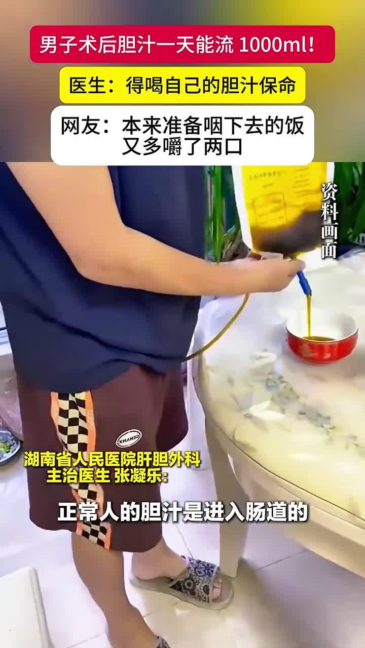 医生让术后胆漏患者喝下自身胆汁,成功挽救生命