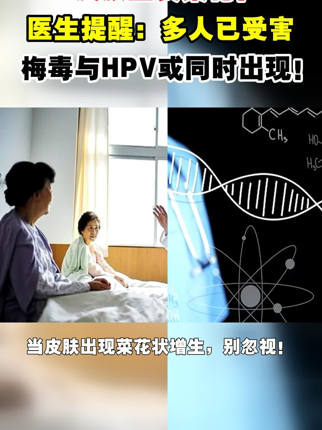 皮肤上长菜花?医生提醒:多人已受害,梅毒与HPV或同时出现!