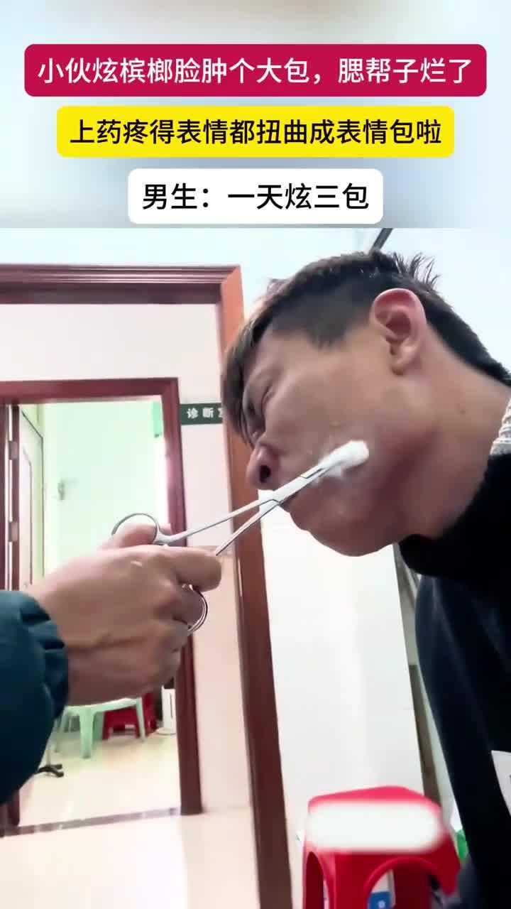 小伙吃槟榔脸上长了一个大包,腮帮子溃烂上药疼出表情包