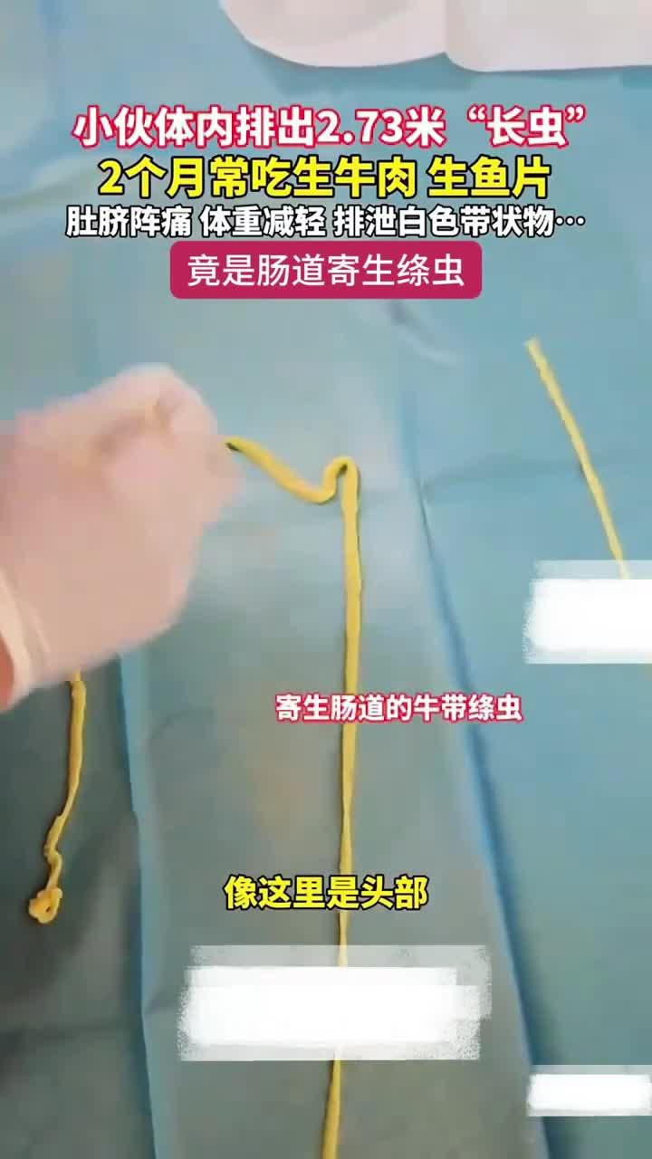 生食牛肉鱼片 体内绦虫长2