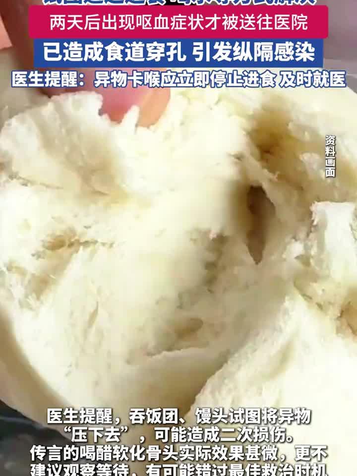 六旬老人吞鸡骨险丧命鸡骨头 卡喉咙怎么办