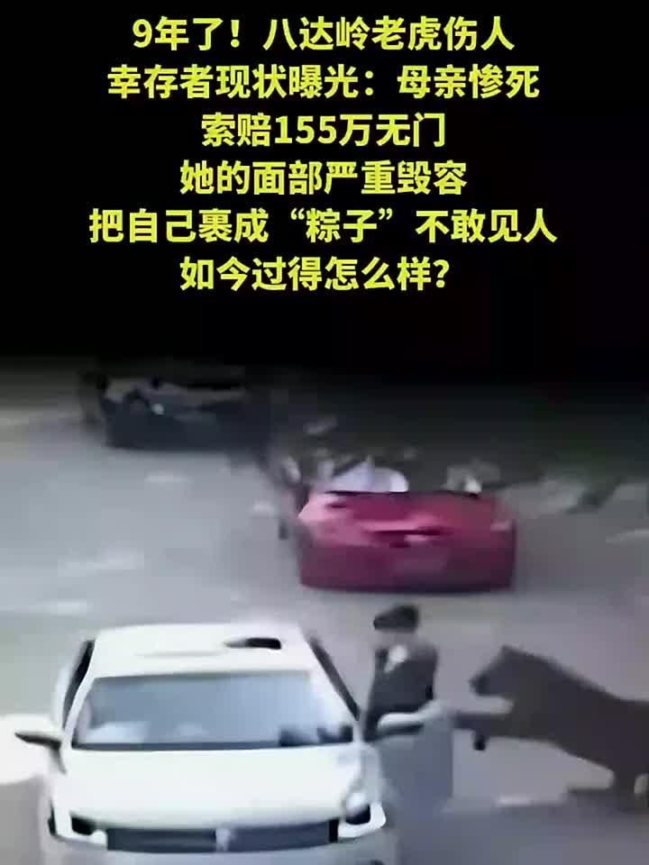 八达岭老虎伤人幸存者现状曝光