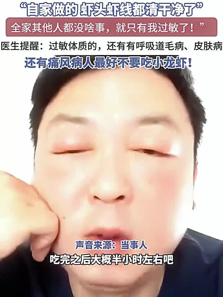 男子狂吃十只小龙虾,秒变“悲伤蛙”肿成表情包