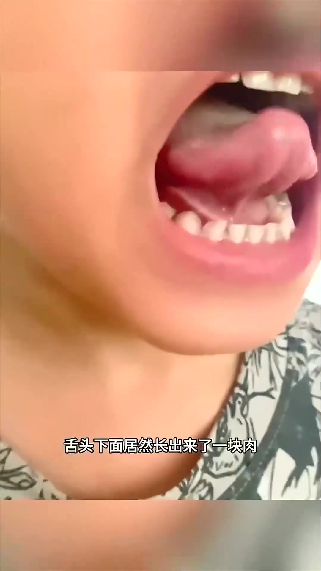  1828. 感觉口中长了个小舌头