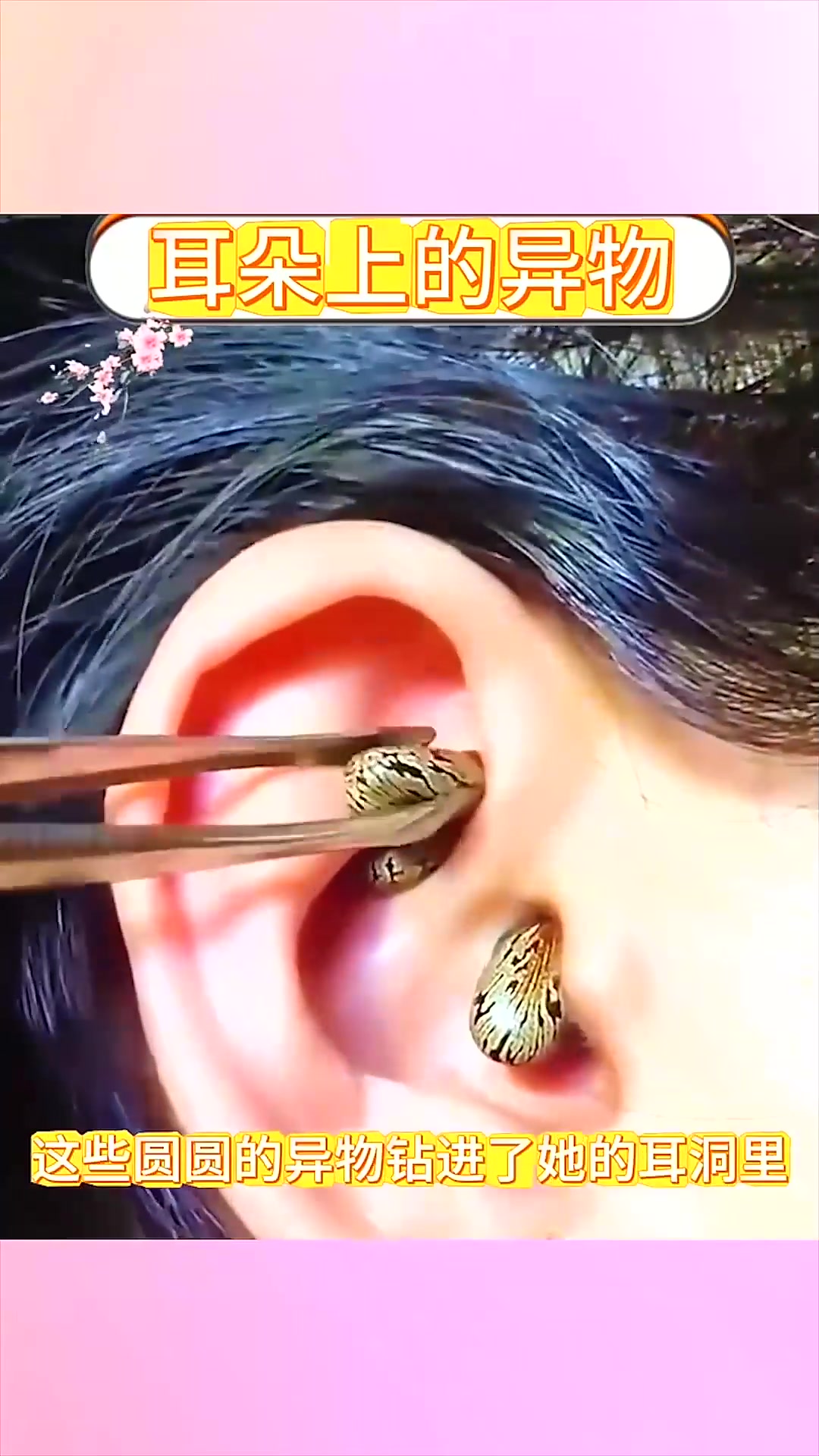  女子耳朵上的东西