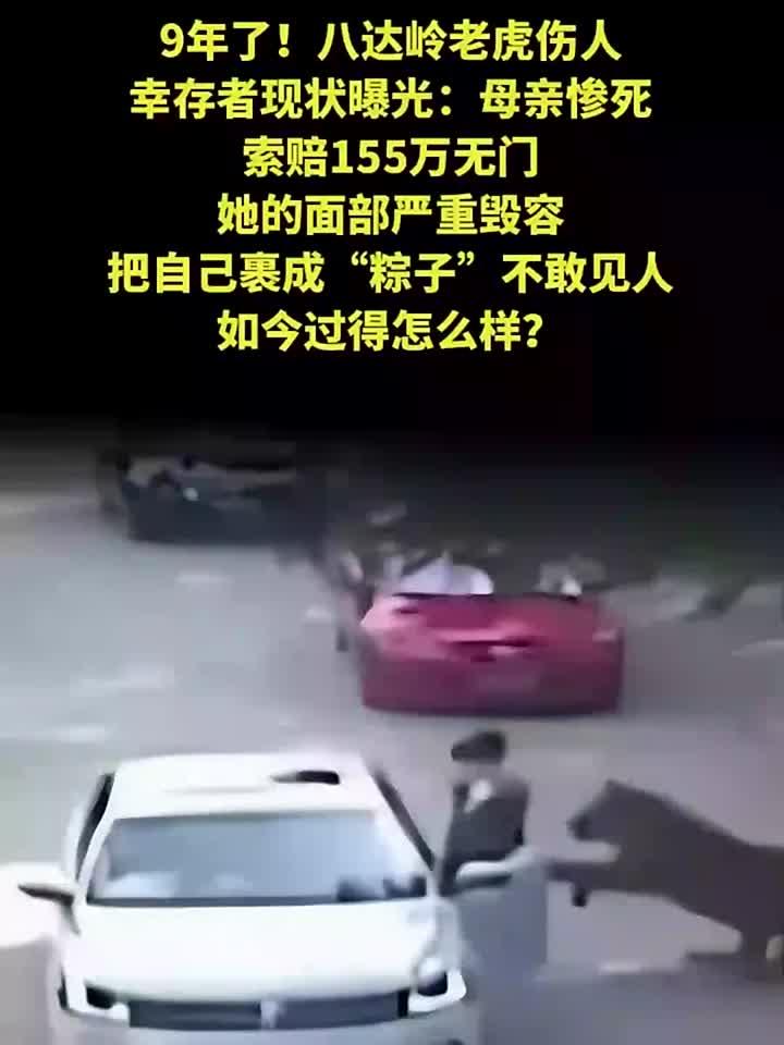 八达岭老虎伤人幸存者现状曝光