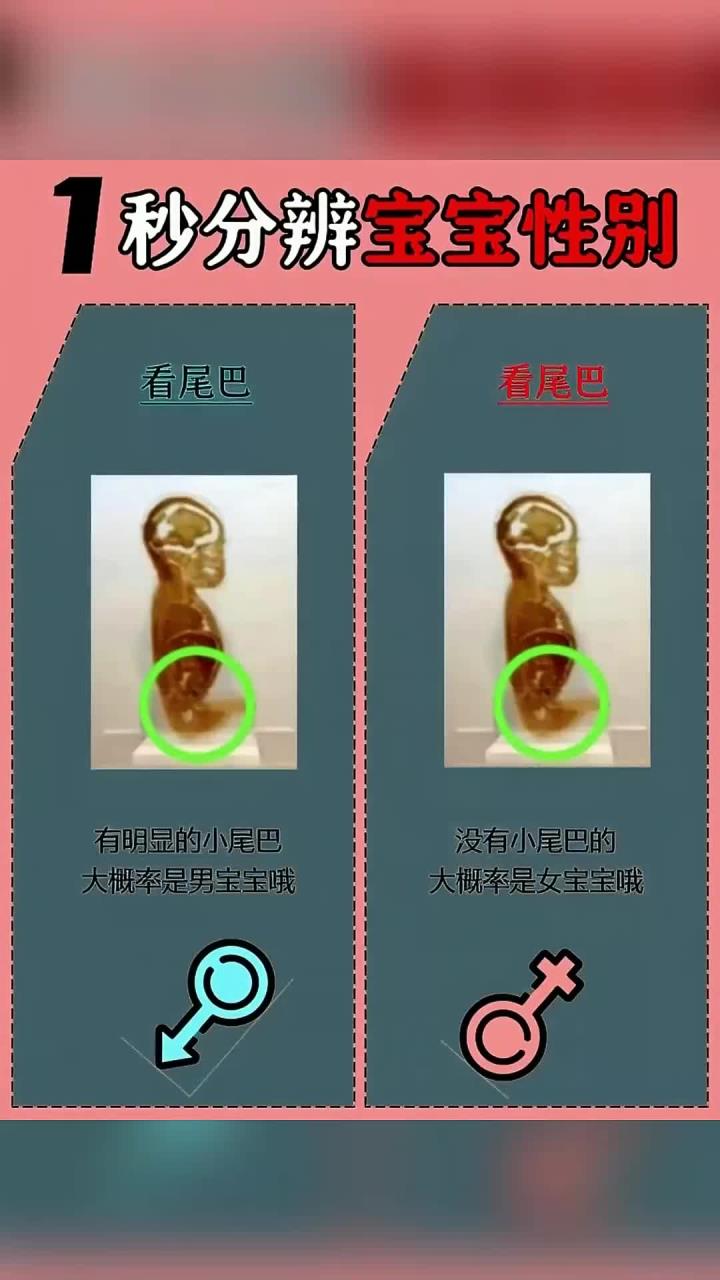 1秒分辨宝宝性别！