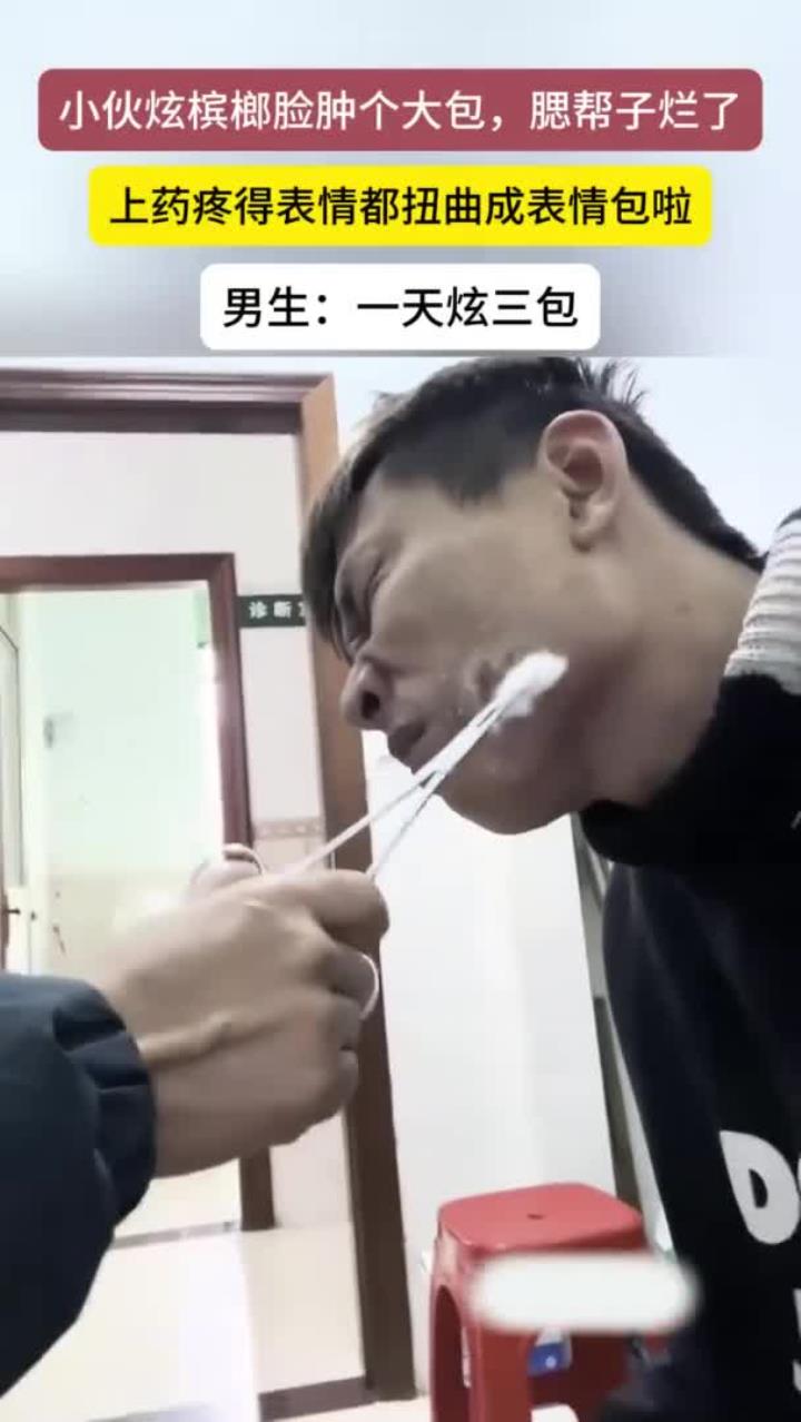 小伙吃槟榔脸上长了一个大包,腮帮子溃烂上药疼出表情包