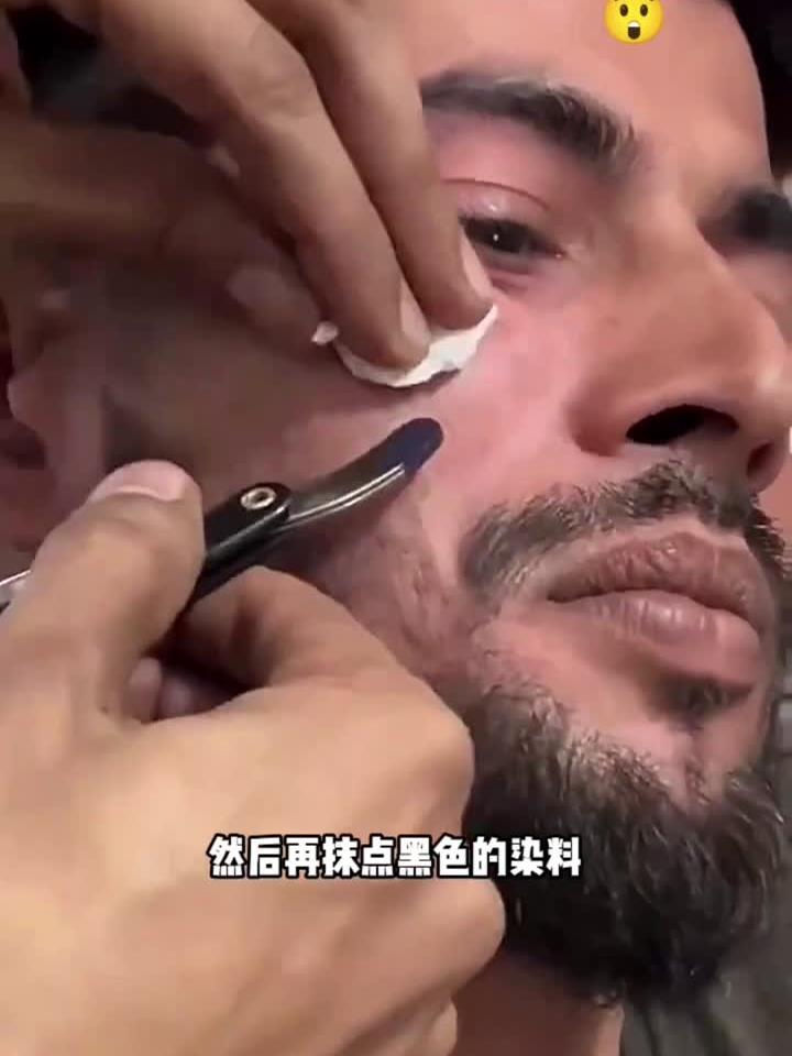 用剪刀剪肉疙瘩,看着都疼
