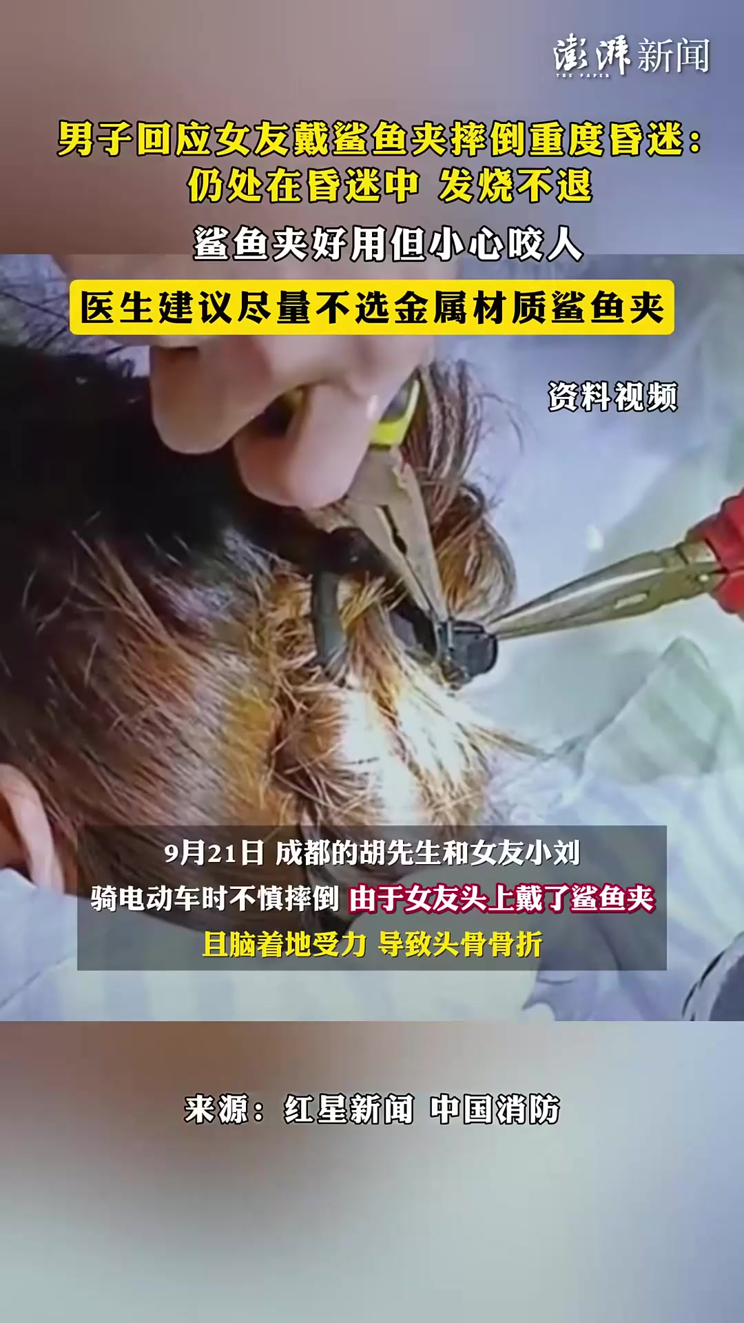 鲨鱼夹伤人昏迷,医生建议慎用「法律解读」