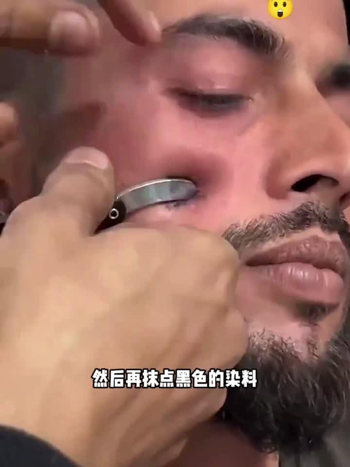 用剪刀剪肉疙瘩,看着都疼