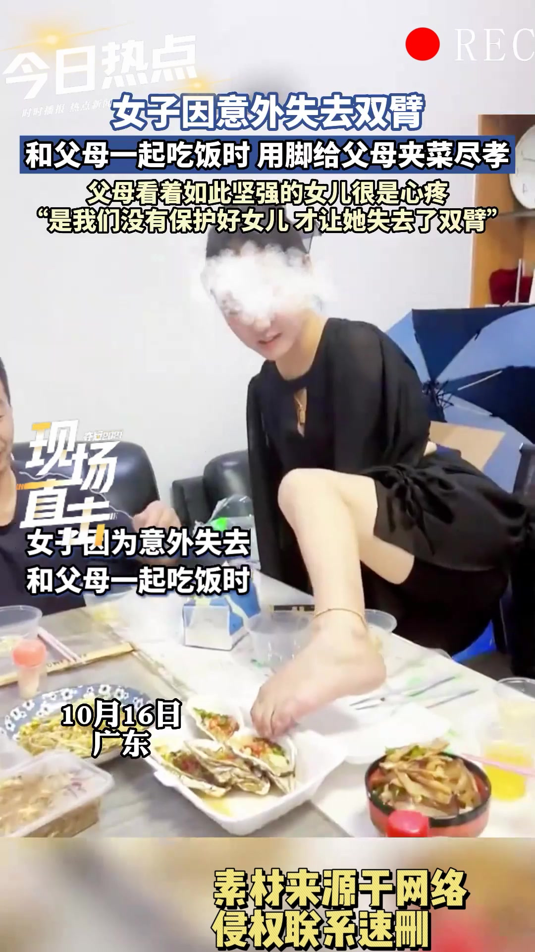 女子意外失去双臂,但她哪怕用脚也要给父母尽孝,善良刻在骨子里