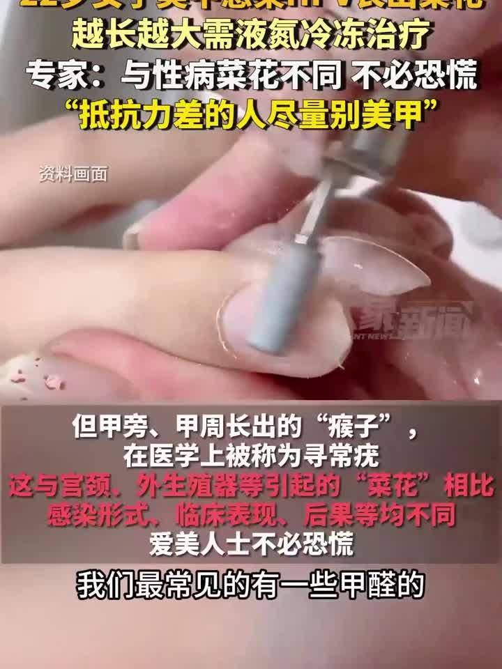 22岁女生美甲染HPV长菜花,液氮冷冻除疣过程揭秘