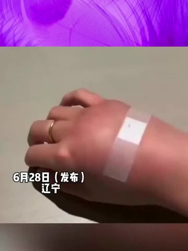 实用健康知识分享,女子输液后手肿成“发面馒头”