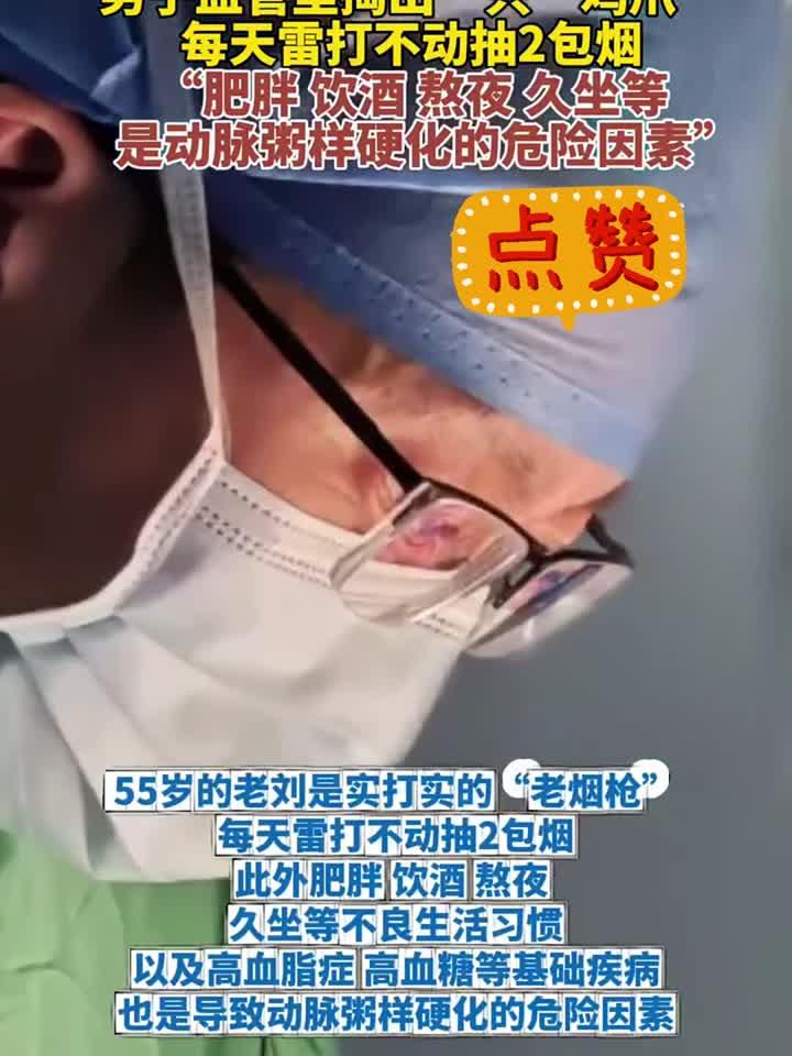 男子血管里掏出一只“鸡爪”,每天雷打不动抽2包烟
