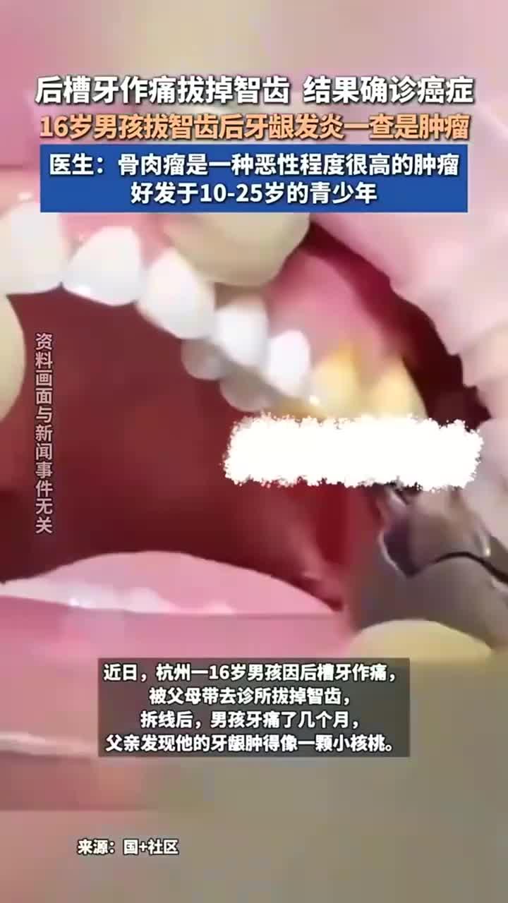 健康心得:拔牙肿痛警惕肿瘤风险