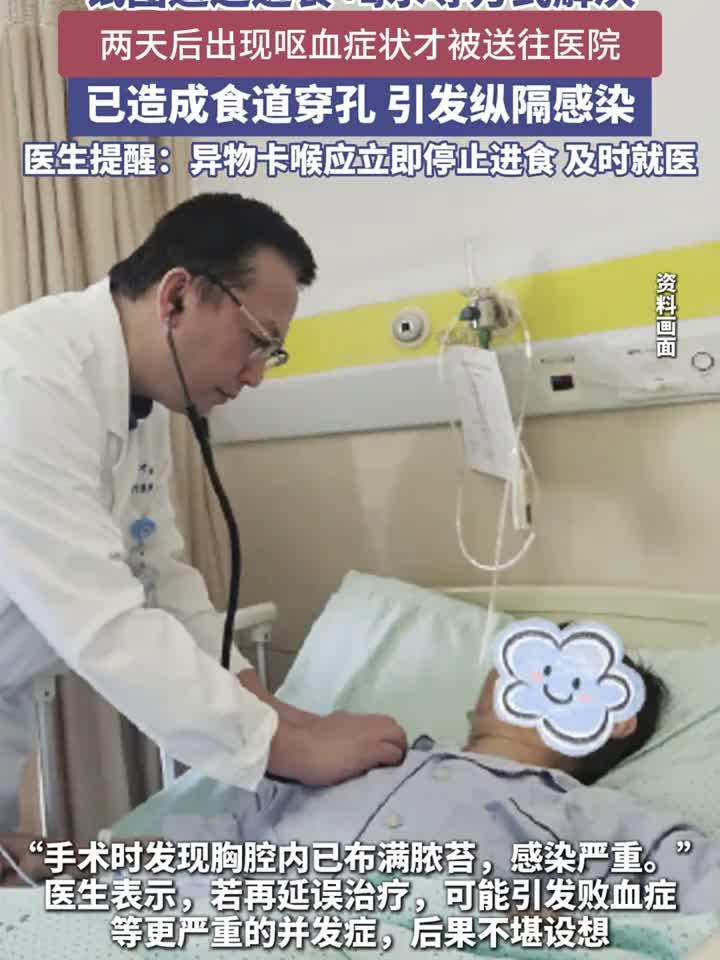 六旬老人吞鸡骨险丧命鸡骨头 卡喉咙怎么办