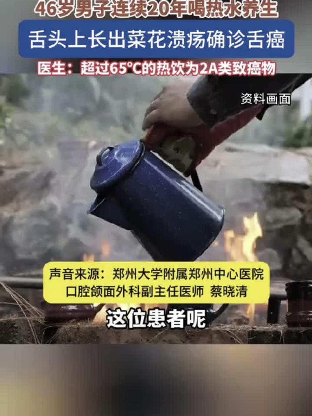 46岁男子养生20年,舌上惊现菜花样病变,竟是癌!