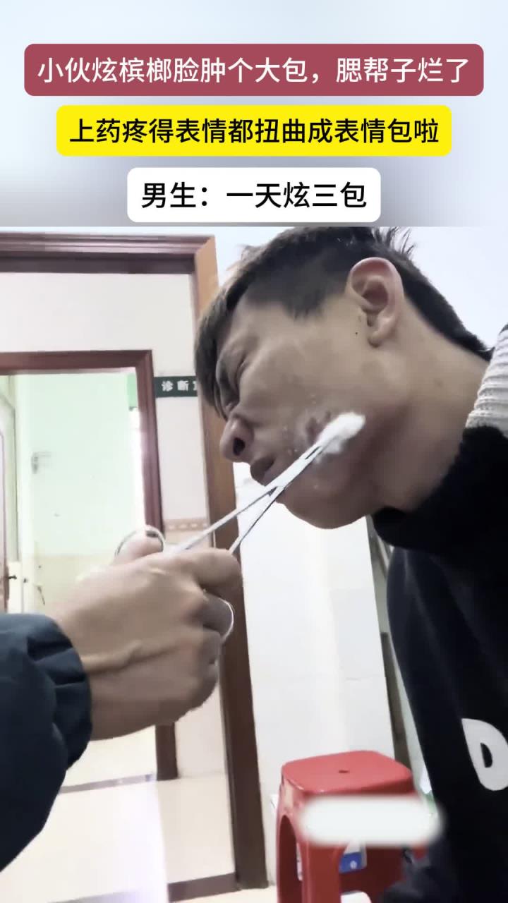 小伙吃槟榔脸上长了一个大包,腮帮子溃烂上药疼出表情包