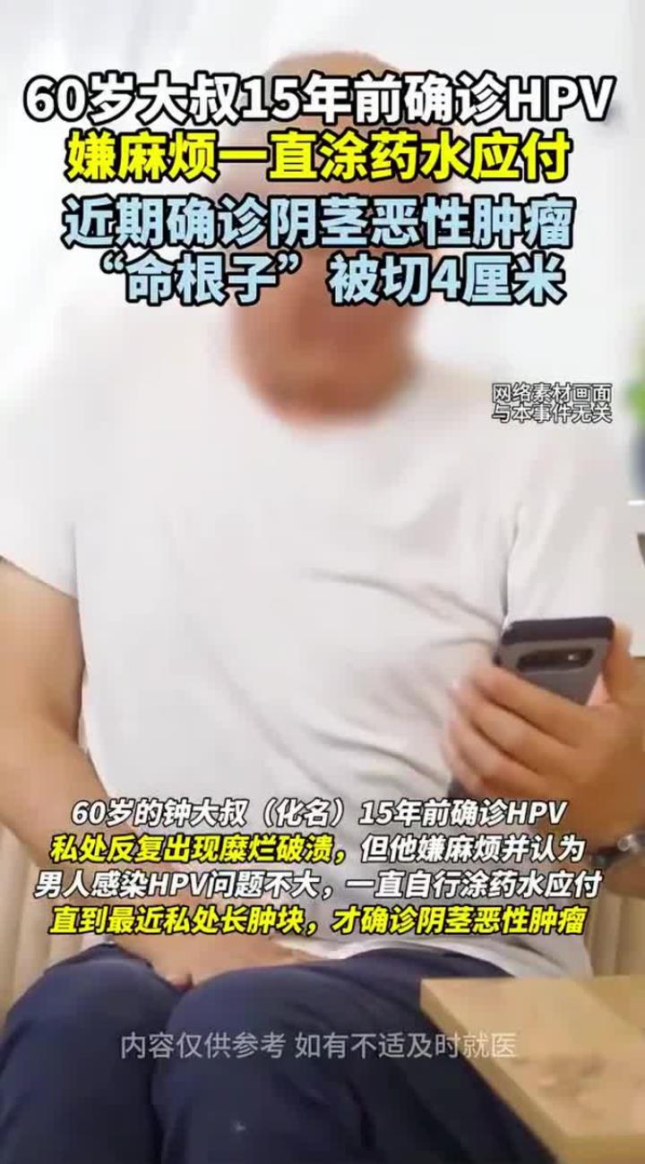 60岁大叔感染hpv耽误15年,阴茎被切掉4厘米。(潇湘晨报)
