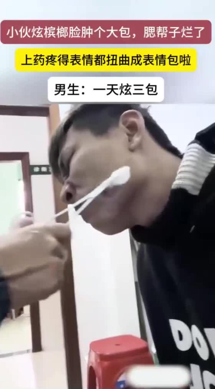 小伙吃槟榔致腮帮溃烂,上药时疼出表情包