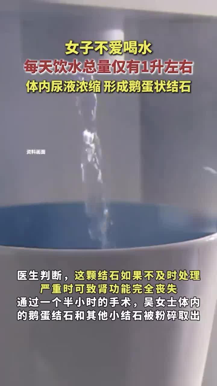 女子不爱喝水,每天饮水总量仅有1升左右,体内尿液浓缩,形成鹅