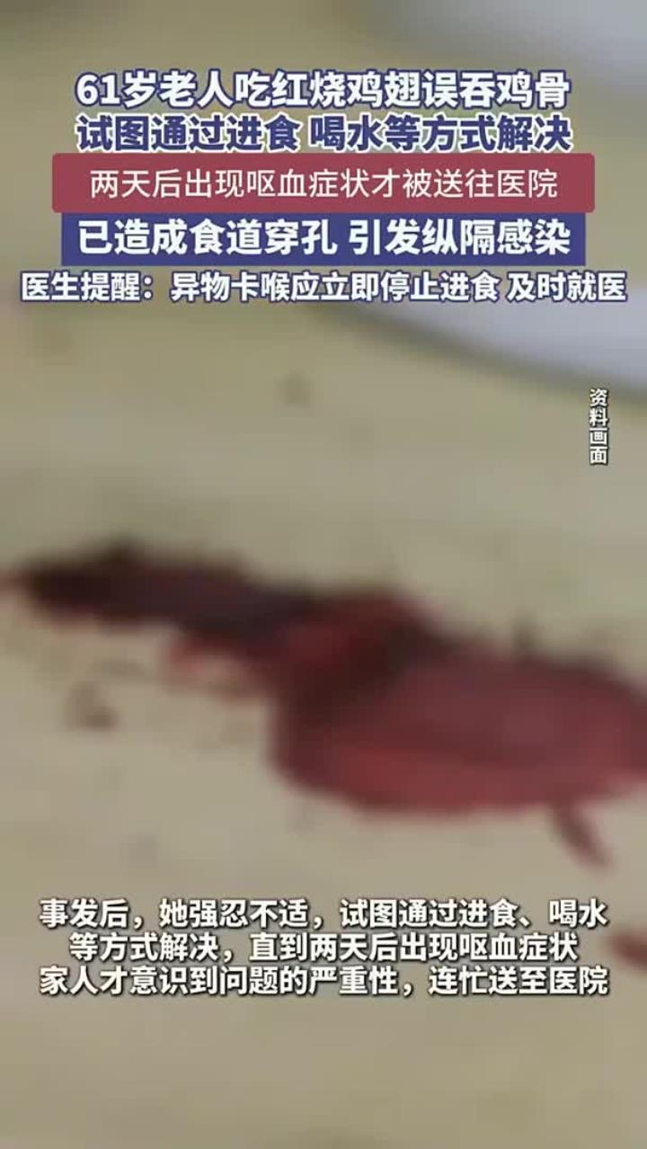 六旬老人吞鸡骨险丧命鸡骨头 卡喉咙怎么办