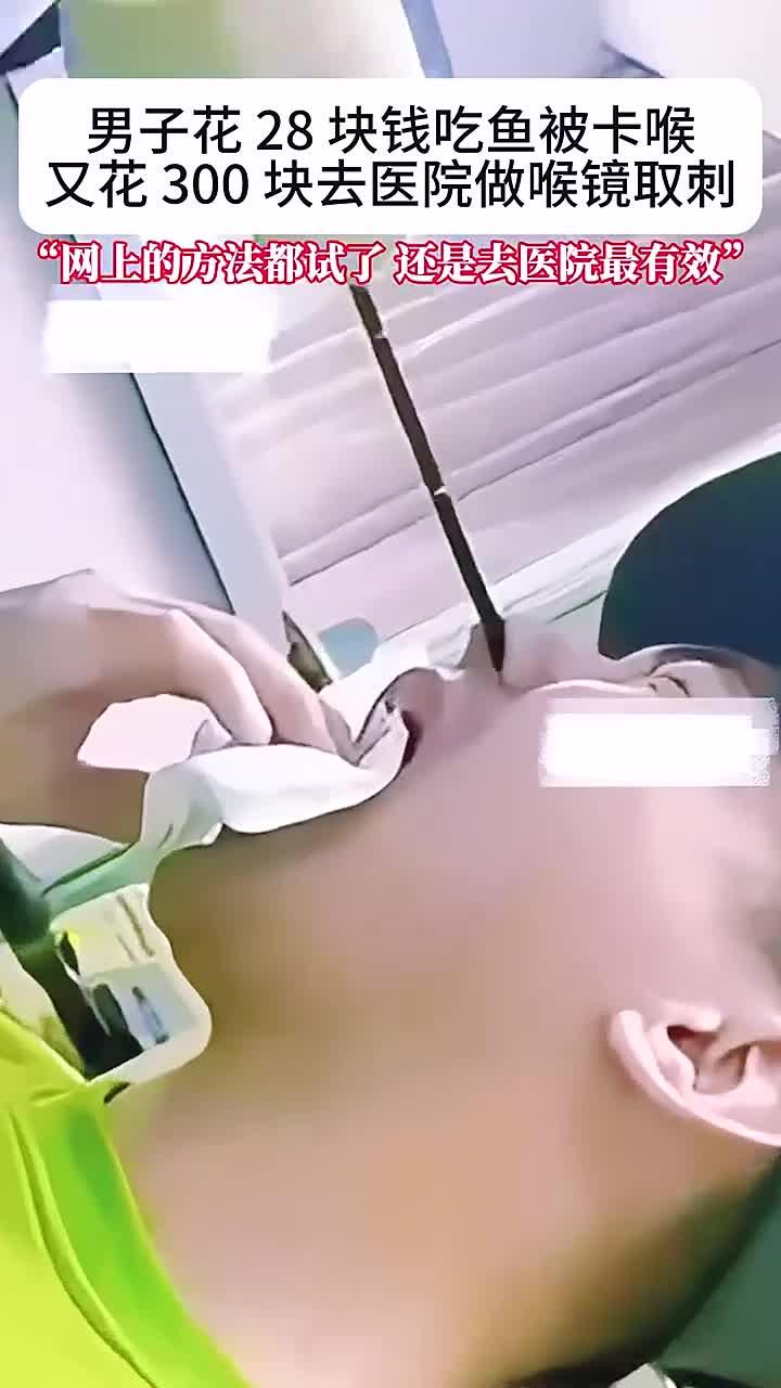 男子28元吃鱼卡喉,花300元做喉镜取鱼刺