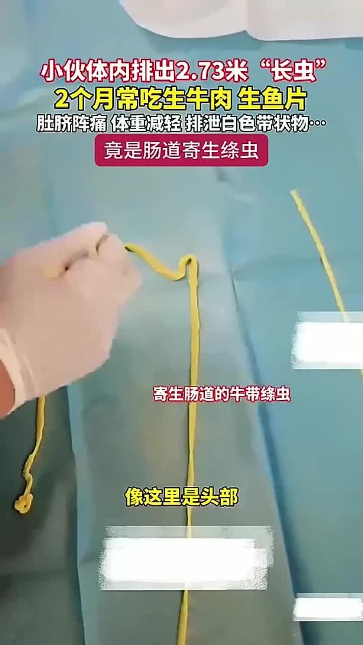 小伙体内排出2米7长虫 2个月常吃生牛肉、生鱼片,当心绦虫!
