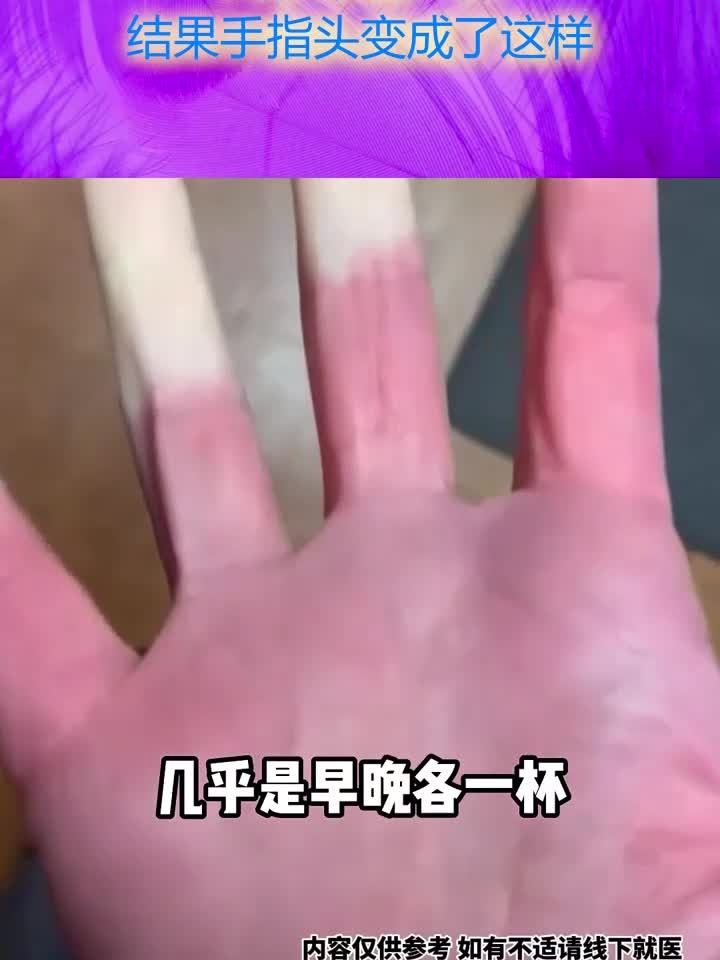 健康知识每日分享:网友非常爱喝奶茶,几乎早晚一杯,结果手指头