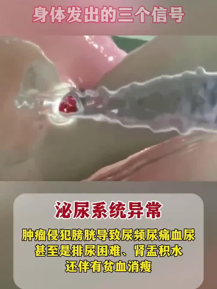 告别妇科检查焦虑:鸭嘴钳使用技巧与身心放松指南