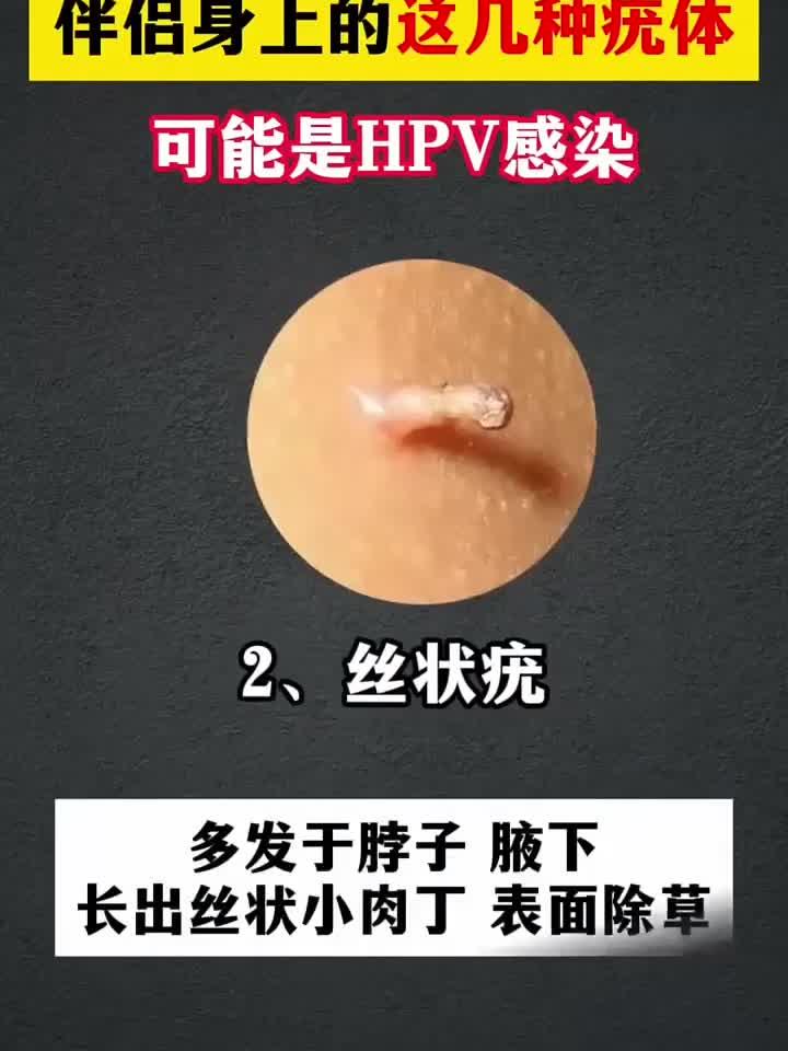 发现身边人有这几样东西,赶紧远离!