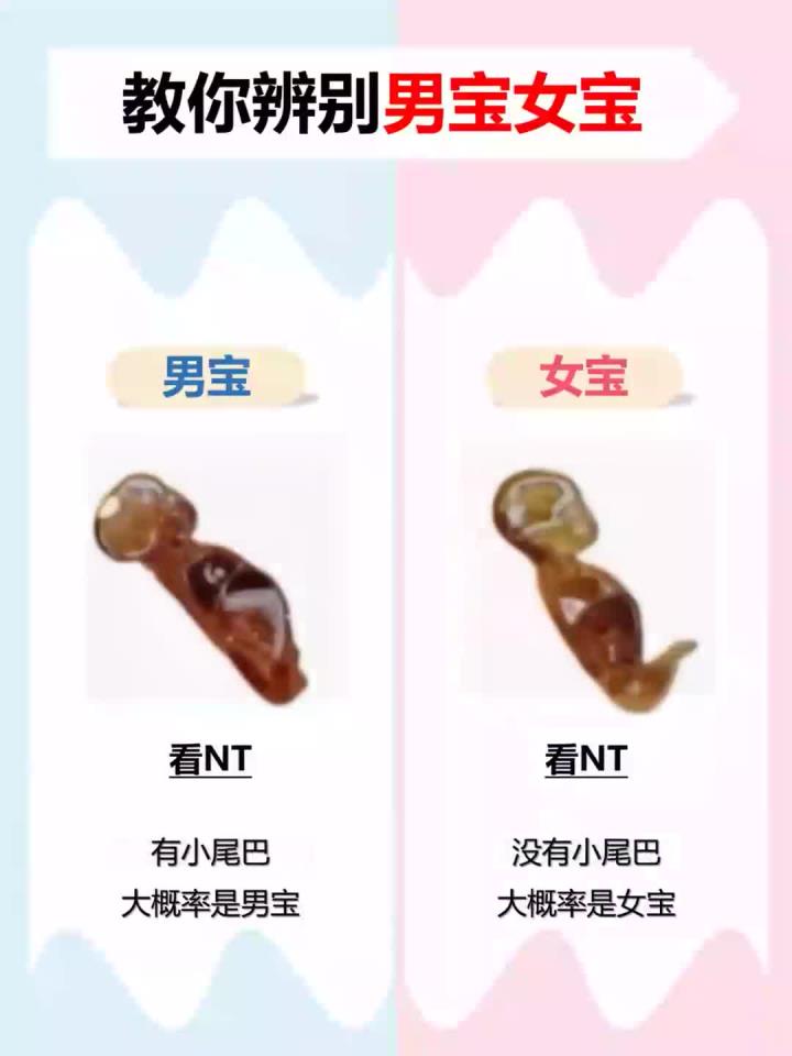 教你辨别男宝女宝